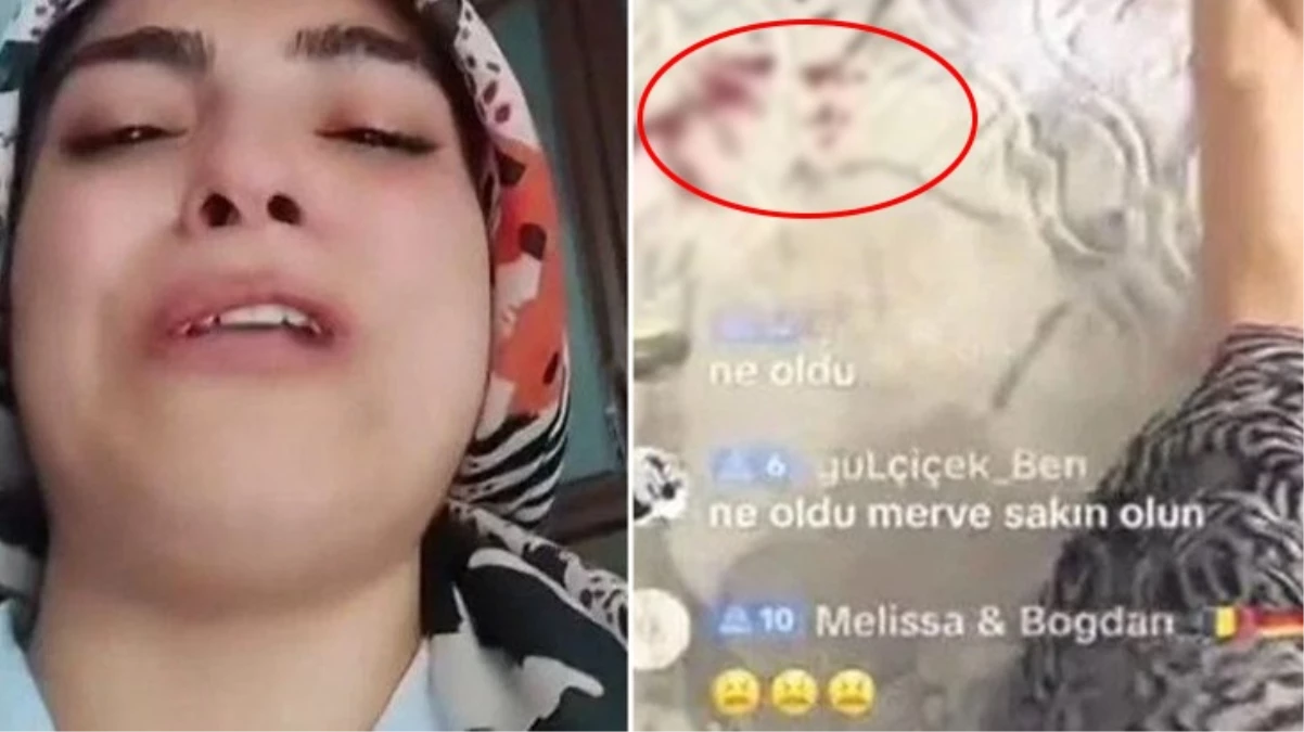 TikTok’taki rezaletler bitmiyor! Çocuğu kanlar içindeyken canlı yayın açtı